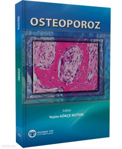 Osteoporoz