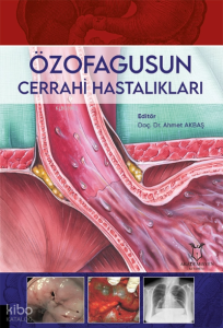 Özofagusun Cerrahi Hastalıkları