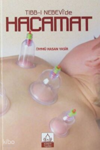 Tıbb-ı Nebevi`de Hacamat