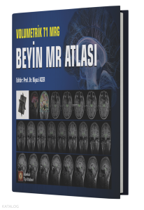 Volumetrik T1 MRG Beyin MR Atlası