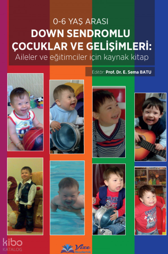 0-6 Yaş Arası Down Sendromlu Çocuklar ve Gelişimleri