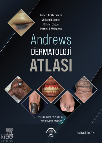 Andrews Dermatoloji Atlası (Ciltli)