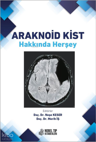 Araknoid Kist Hakkında Herşey