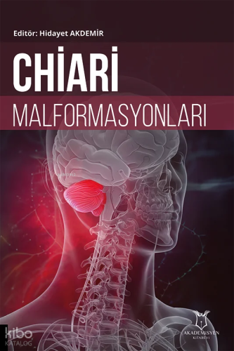 Chiari Malformasyonları