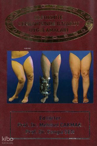 Deformite Cerrahisinde İlizarov Cerrahisi