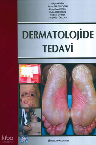 Dermatolojide Tedavi