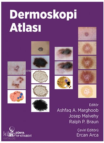 Dermoskopi Atlası