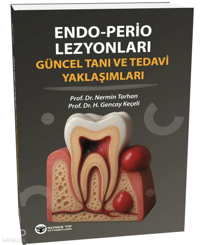 Endo - Perio Lezyonları Güncel Tanı ve Tedavi Yaklaşımları