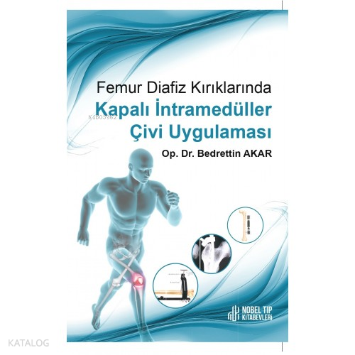 Femur Diafiz Kırıklarında Kapalı İntramedüller Çivi Uygulaması