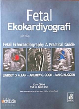 Fetal Ekokardiyografi