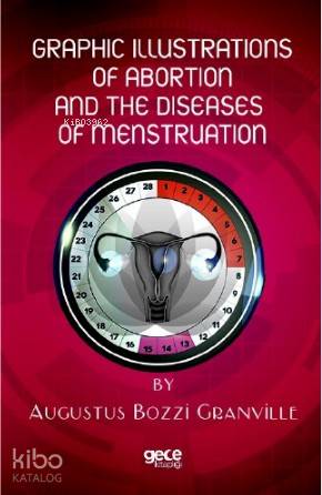 Graphic İllustrations Of Abortion And The Diseases Of Menstruation