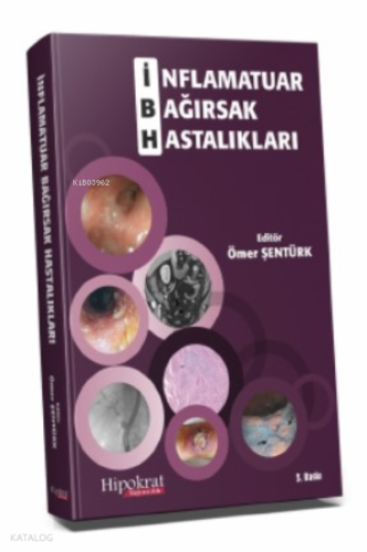 İnflamatuar Bağırsak Hastalıkları