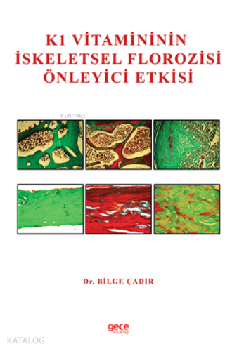K1 Vitamininin İskeletsel Florozisi Önleyici Etkisi
