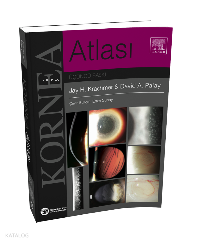 Krachmer Kornea Atlası