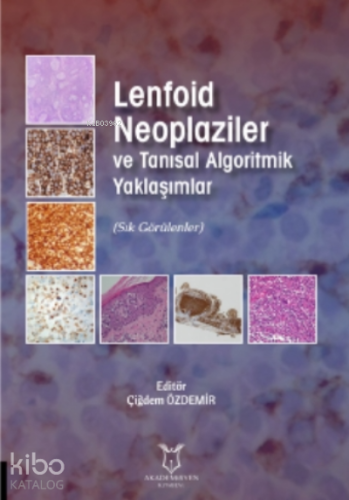 Lenfoid Neoplaziler ve Tanısal Algoritmik Yaklaşımlar