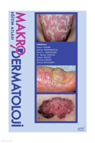 Makrodermatoloji Eğitim Atlası