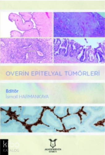 Overin Epitelyal Tümörleri