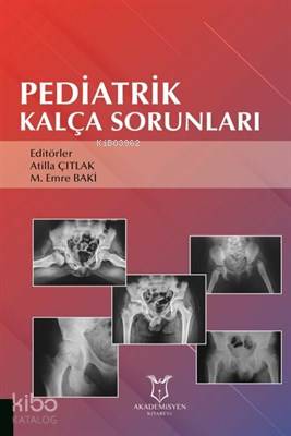 Pediatrik Kalça Sorunları
