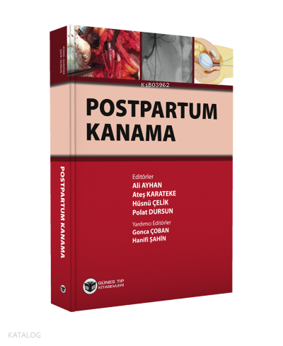 Postpartum Kanama