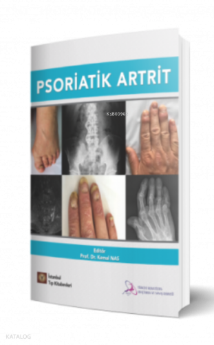 Psoriatik Artrit