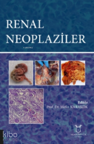 Renal Neoplaziler