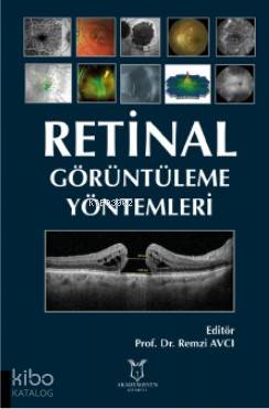 Retinal Görüntüleme Yöntemleri | Remzi Avcı | Akademisyen Kitabevi