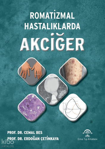 Romatizmal Hastalıklarda Akciğer (Ciltli)