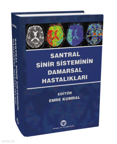Santral Sinir Sisteminin Damarsal Hastalıkları
