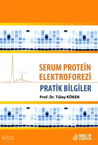 Serum Protein Elektroforezi - Pratik Bilgiler
