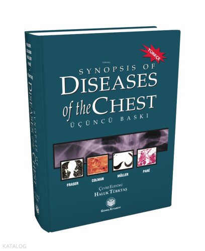 Synopsis of Diseases of The Chest (Türkçesi)