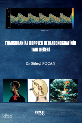 Transkranial Doppler Ultrasonografinin Tanı Değeri