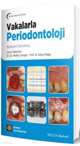 Vakalarla Periodontoloji