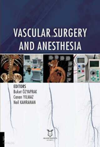 Vascular Surgery and Anesthesia