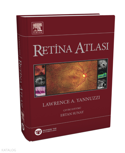 Yannuzzi Retina Atlası